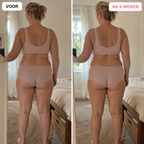 CelluFix™ 3D Legging — Verlies 10kg & elimineer cellulitis in 90 dagen