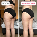 CelluFix™ 3D Legging — Verlies 10kg & elimineer cellulitis in 90 dagen