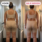 CelluFix™ 3D Legging — Verlies 10kg & elimineer cellulitis in 90 dagen