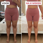 CelluFix™ 3D Legging — Verlies 10kg & elimineer cellulitis in 90 dagen